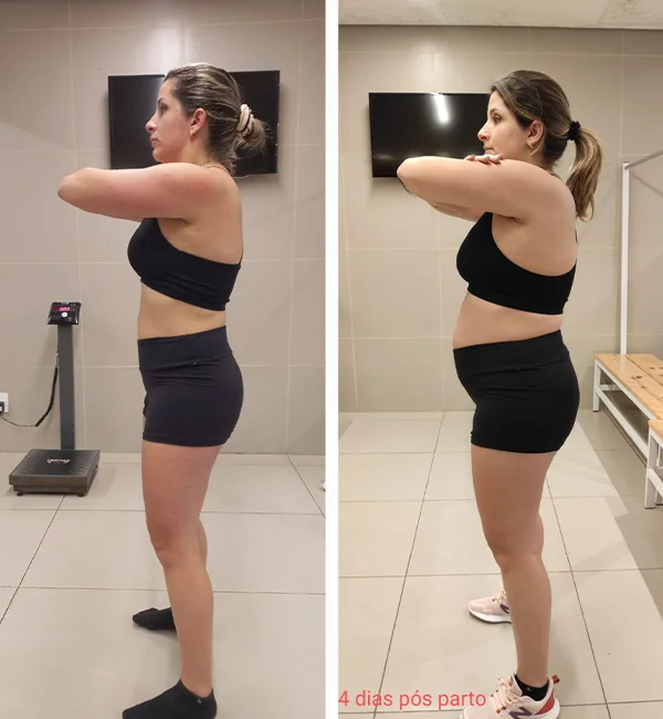 antes-depois-2-fix