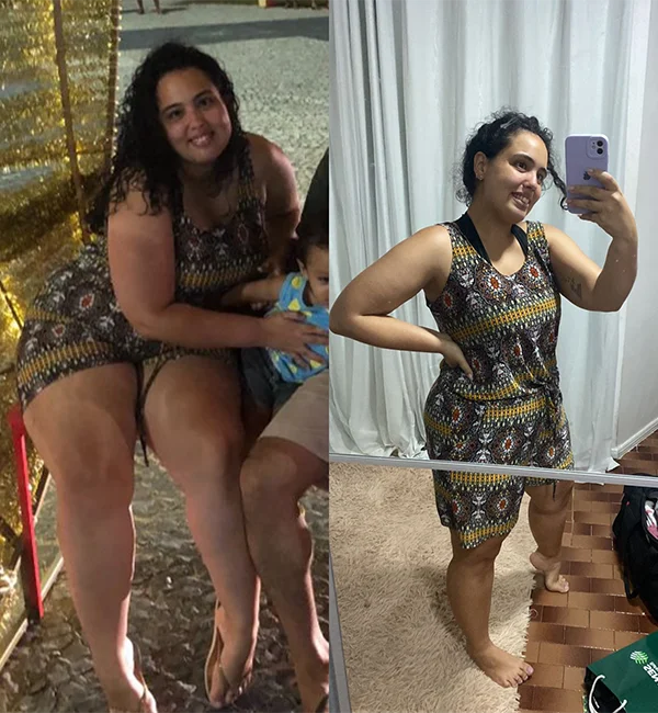 antes-depois-3